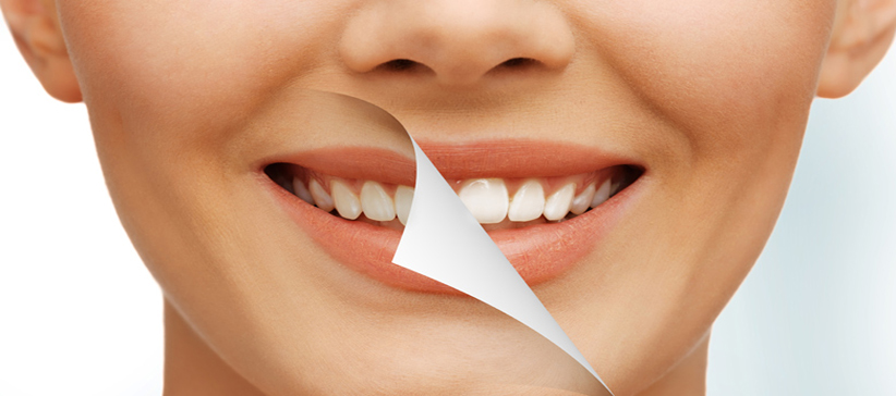 chestermere-dental-Cosmetic-Dentistry
